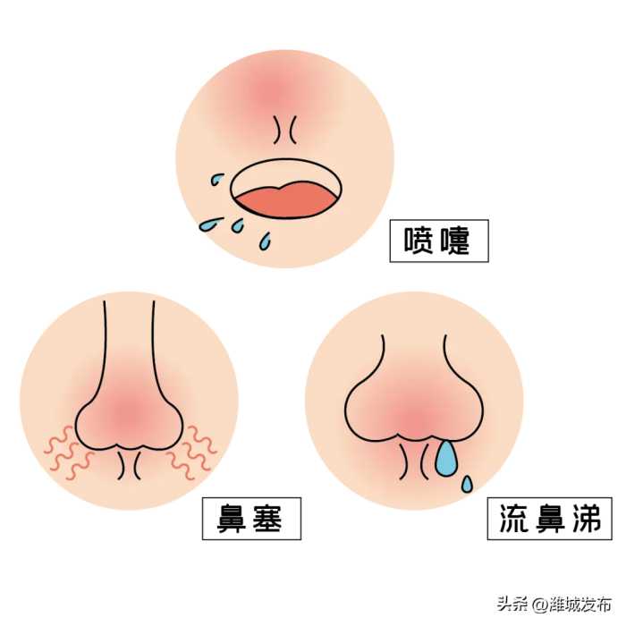 鼻子为何老是堵？原因和应对方法看过来 | 科普时间